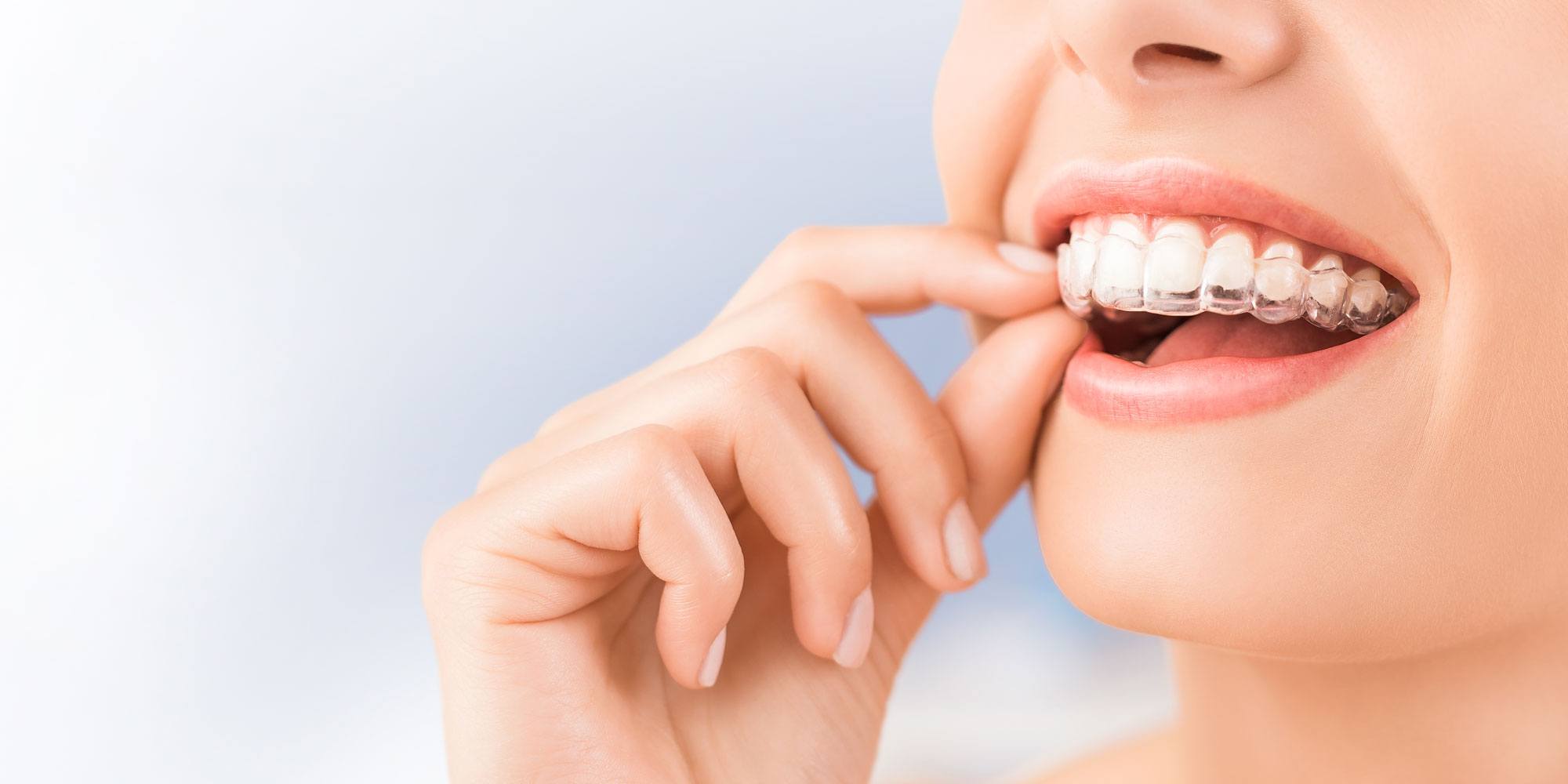 dental patient wearing invisalign