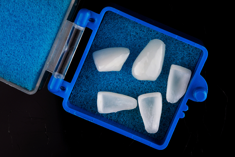 veneers case