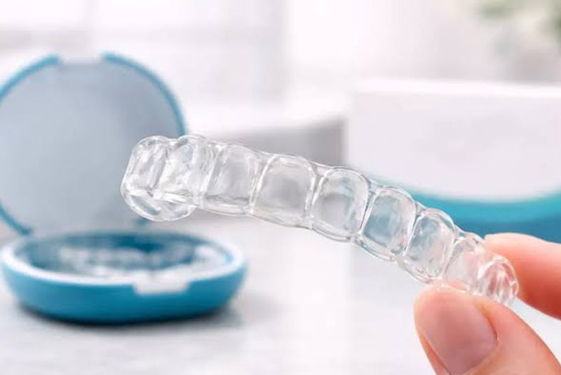 SimplyClear Aligners